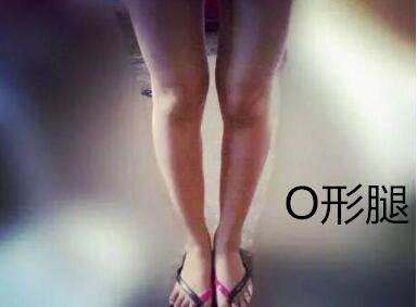 糾正你的腿型！