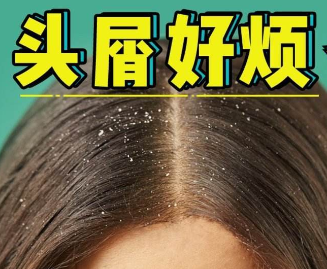 南寧正規(guī)美發(fā)培訓學校分享：冬天如何減少頭屑過多？