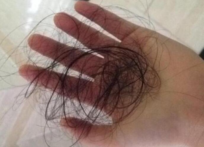 脫發(fā)女孩必備寶典！南寧美發(fā)學(xué)校教你