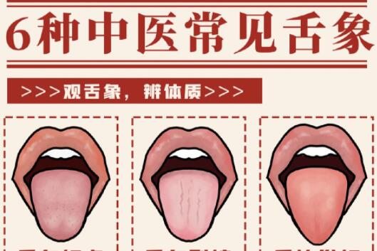 6種常見中醫(yī)舌診判定，快和廣西中醫(yī)美容一起學(xué)