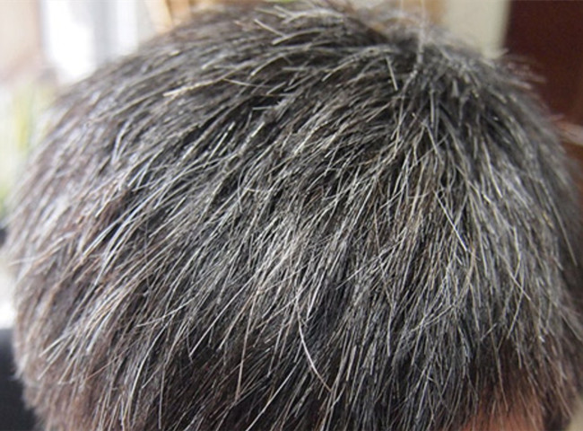 南寧美發(fā)基礎(chǔ)教學：為什么會長白頭發(fā)？