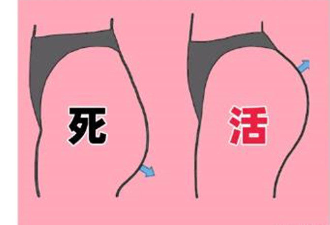 如何改善你臀部的健康情況？南寧美容形象