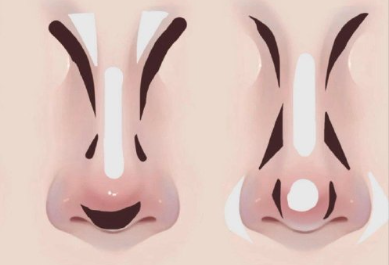 廣西習(xí)化妝排名：不同鼻型如何修容？